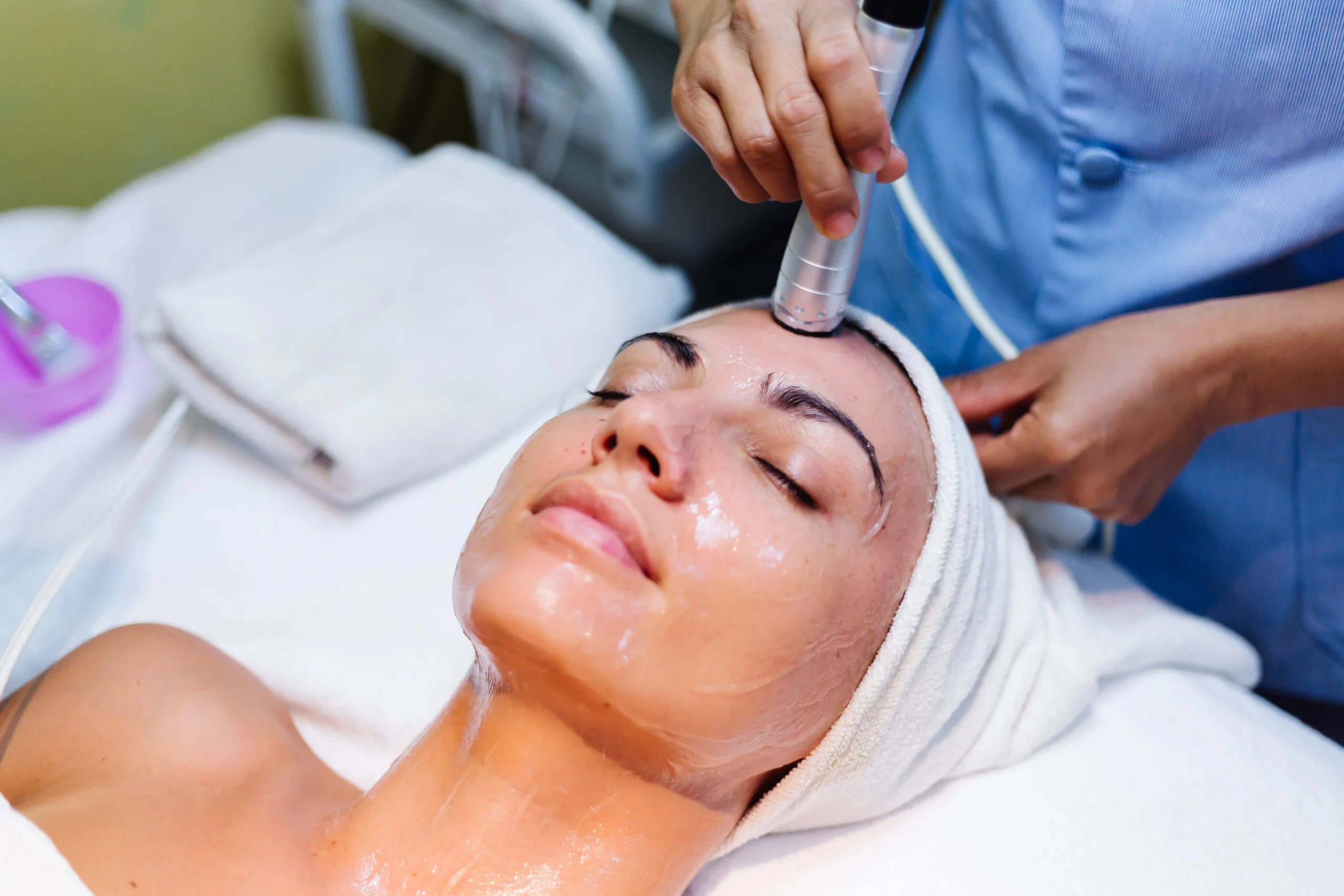 best chemical peel in bangalore