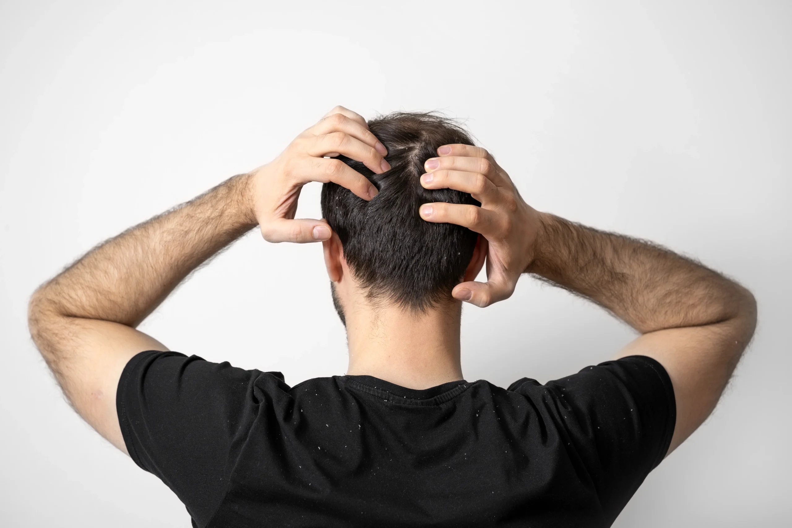 best hair care treatment in bangalore