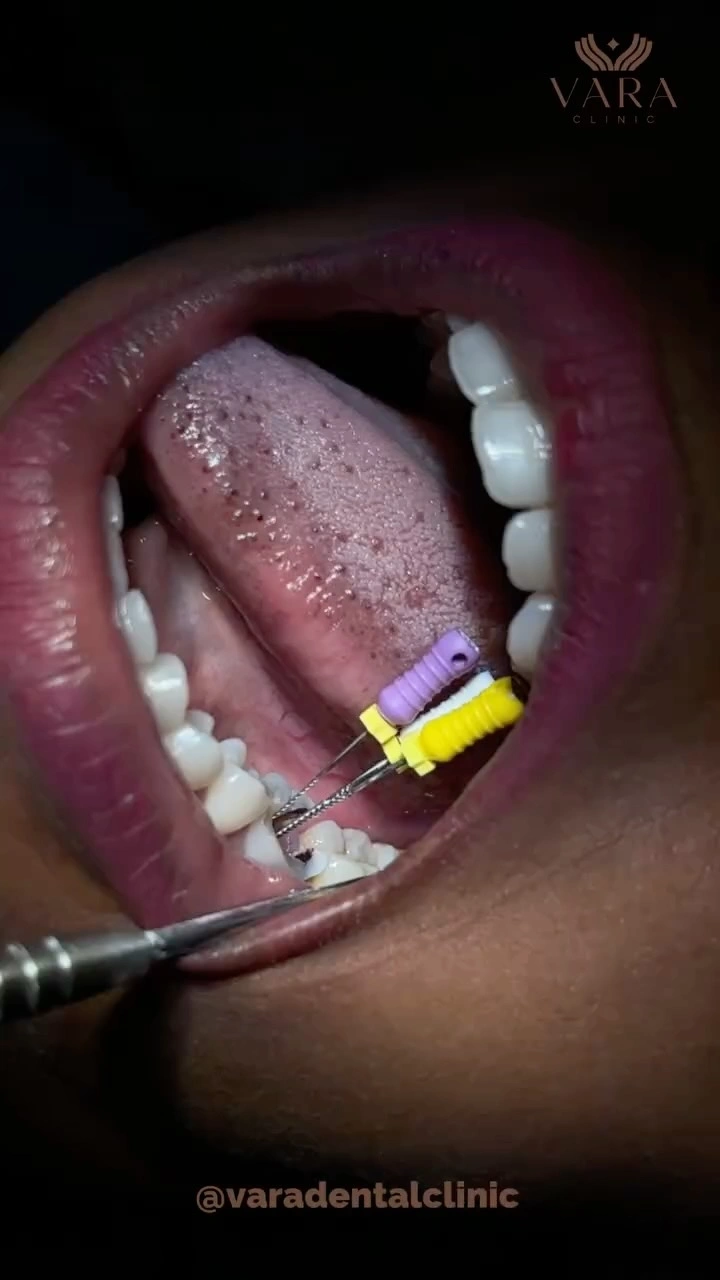 Vara Clinic Instagram Reel