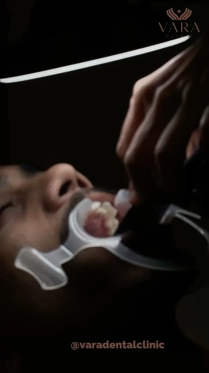 Vara Clinic Instagram Reel