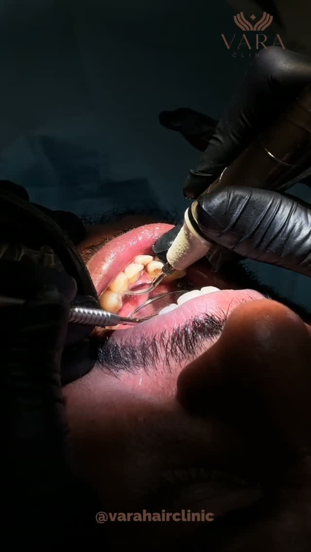 Vara Clinic Instagram Reel