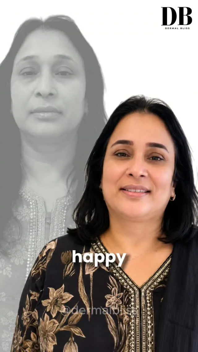 Vara Clinic Instagram Reel