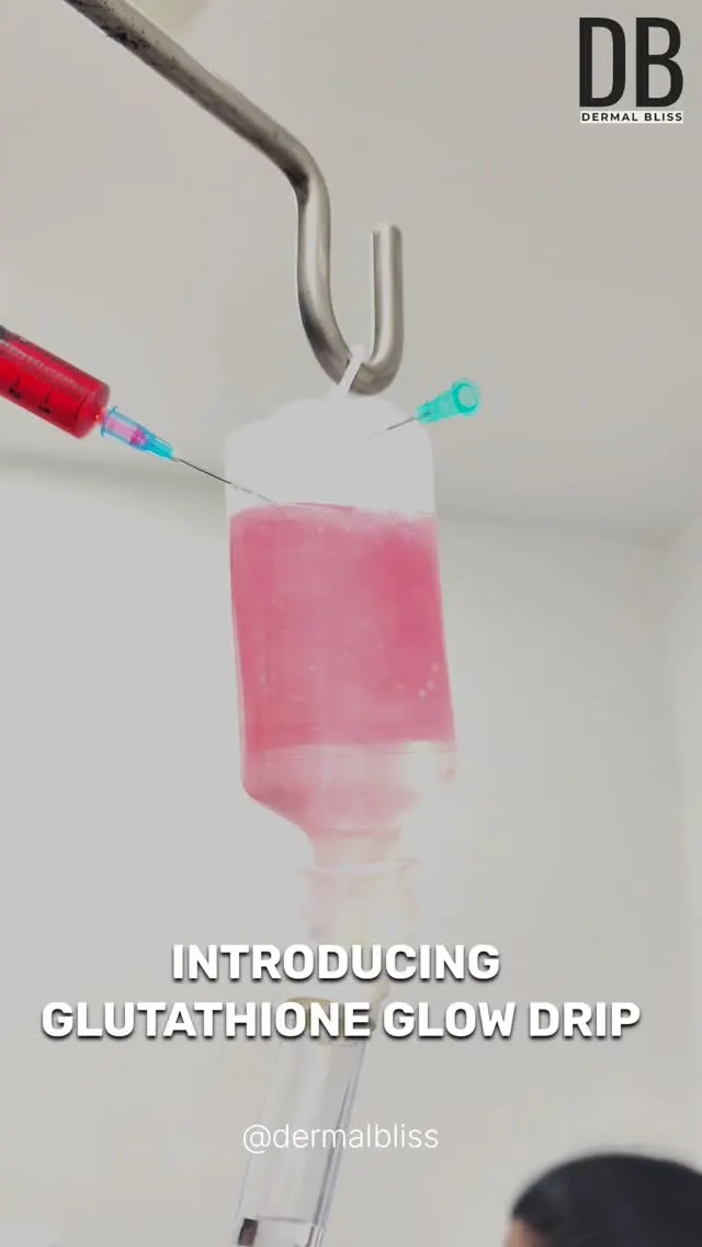 Vara Clinic Instagram Reel